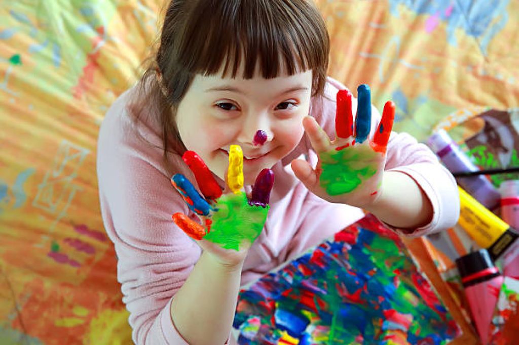 21 Maret Diperingati World Down Syndrome Day, Begini Sejarahnya