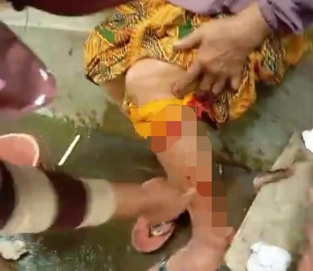 Warga Dusun Krajan Jember Diteror Monyet Liar, Anak-anak hingga Lansia Jadi Korban